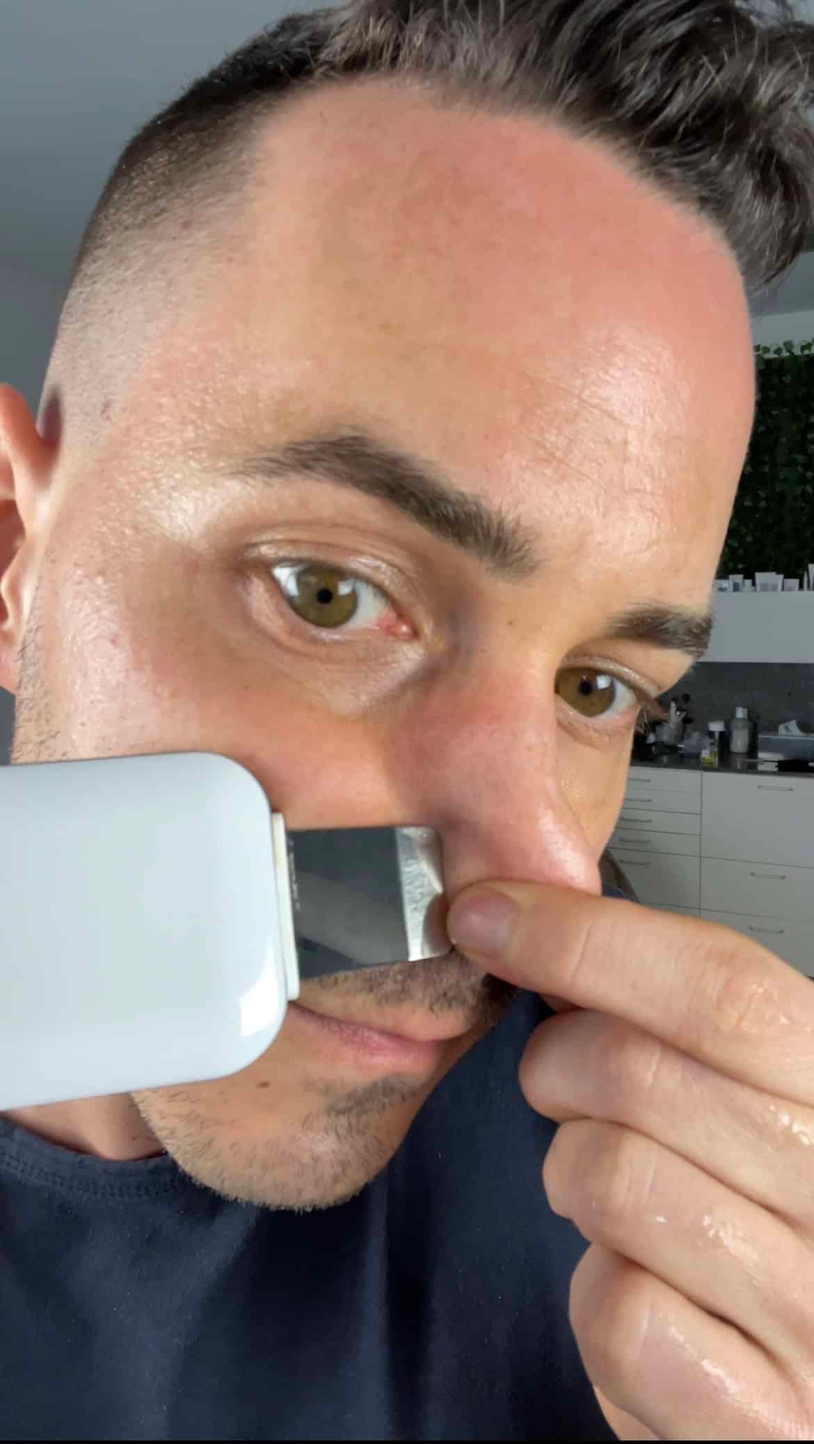 Close-up van de ultrasound spatel die de huid reinigt met het Microsonic Facial Device