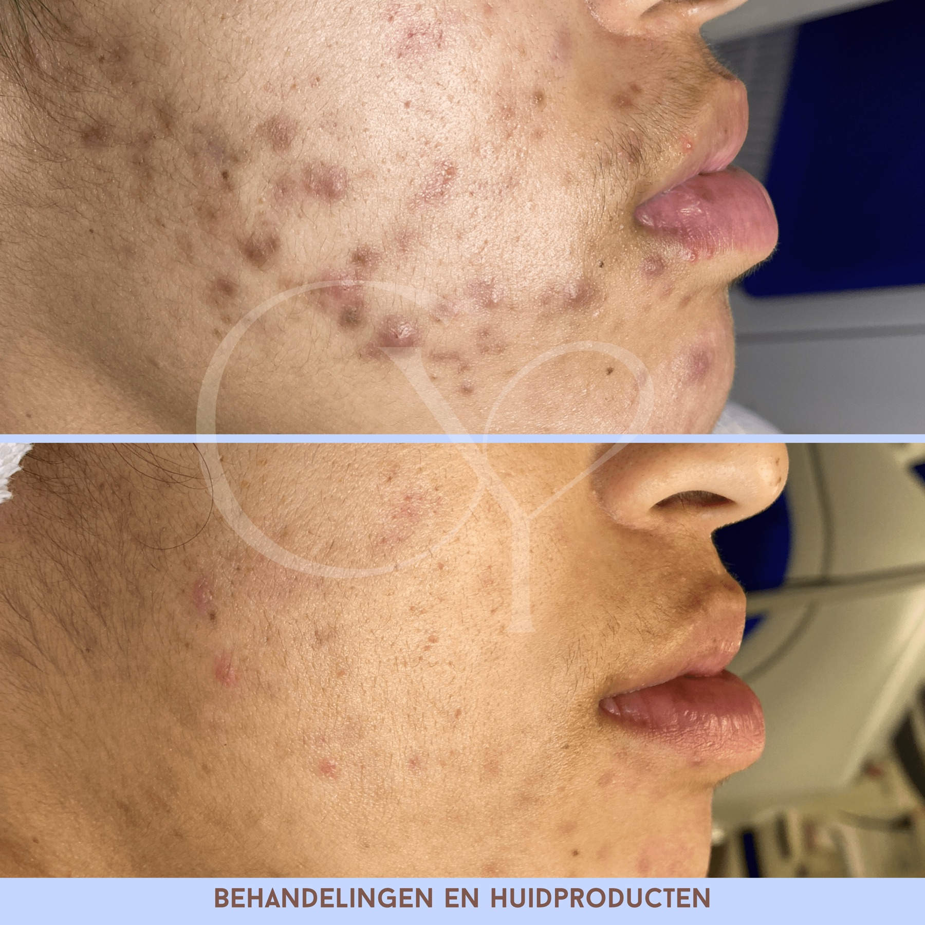 Voor en na bij Cherish Yourself: behandelingen en huidproducten